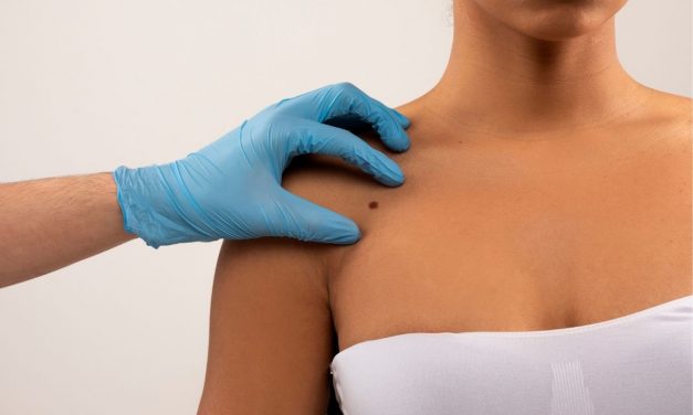 Chirurgia Mohs, rimuove i tumori cutanei con mini cicatrici