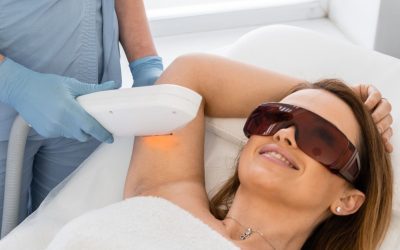 Depilazione laser e altre soluzioni quando hai il cancro