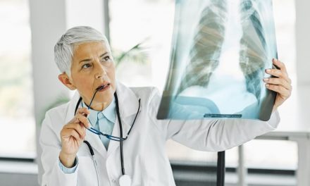 Intervento tumore polmone: cura senza bisturi