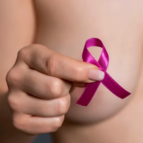 carcinoma duttale infiltrante g3 guarigione