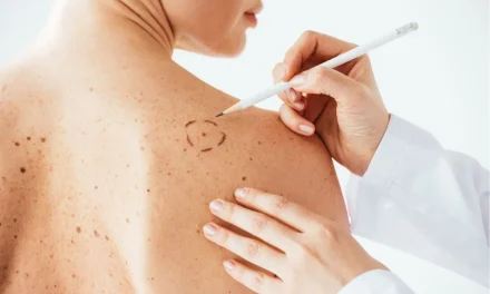 Vaccino contro il melanoma: svolta nella cura