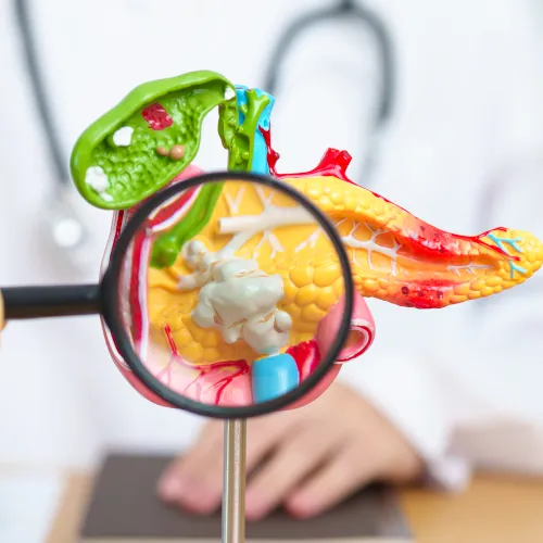 daraxonrasib nuova cura tumore pancreas metastatico